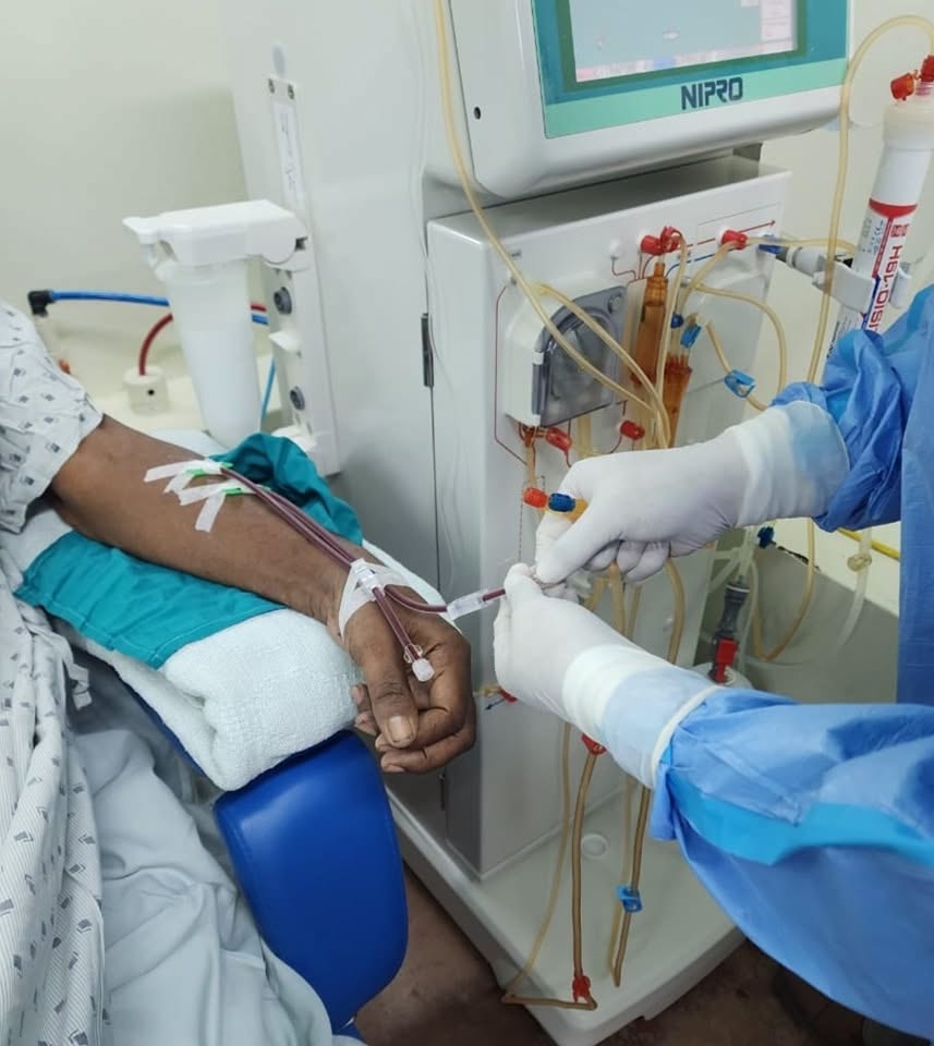 La hemodiálisis es un tratamiento que filtra la sangre para eliminar toxinas y líquidos cuando fallan los riñones