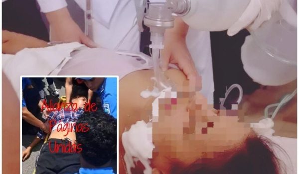 Simpatizante sandinista permanece grave tras caer de camión durante caravana del 19 de julio
