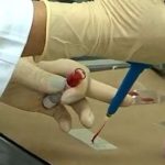 Malaria se dispara por la minería ilegal en Costa Rica; Nicaragua se compromete a contenerla