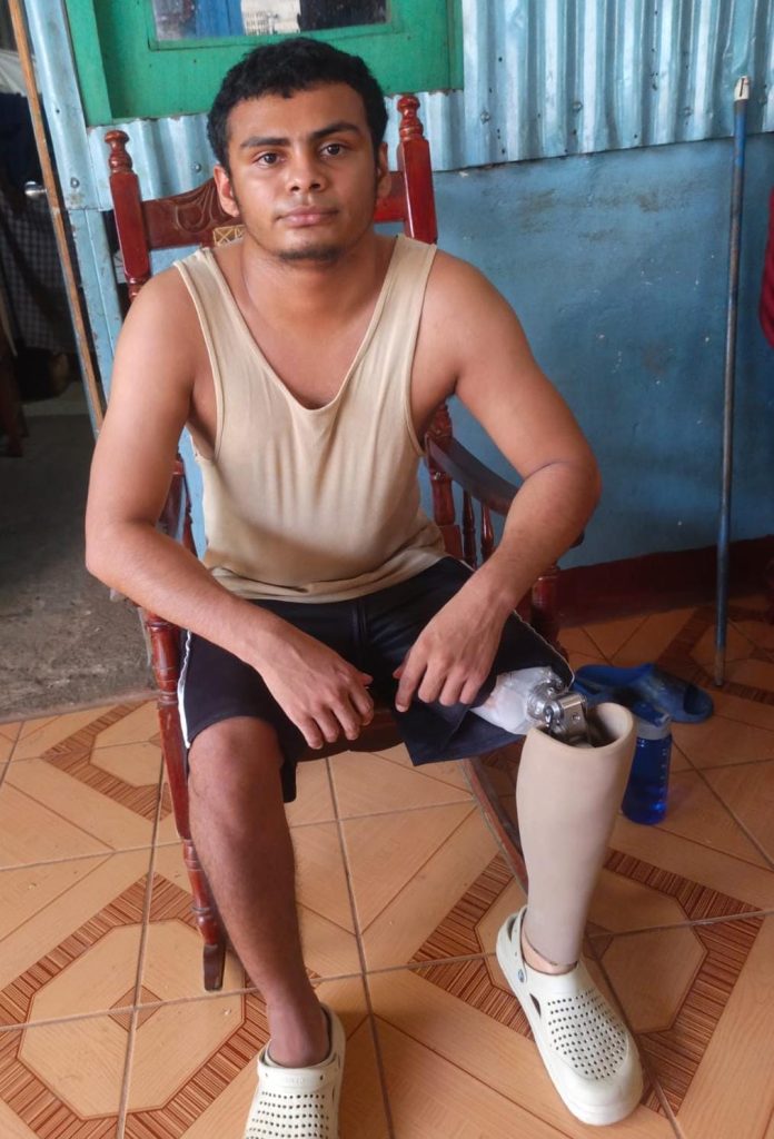 Milton José Lagos Rivera, de 21 años, vuelve a caminar gracias a una prótesis. Foto: Cortesía/Milton.