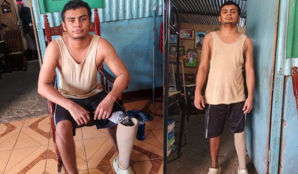 Tras 4 años de perder su pierna en accidente, joven vuelve a caminar: «Siempre le pedí a Dios una oportunidad»