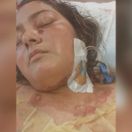 Piden ayuda para que nicaragüense hospitalizada en EE. UU. pueda regresar a su país
