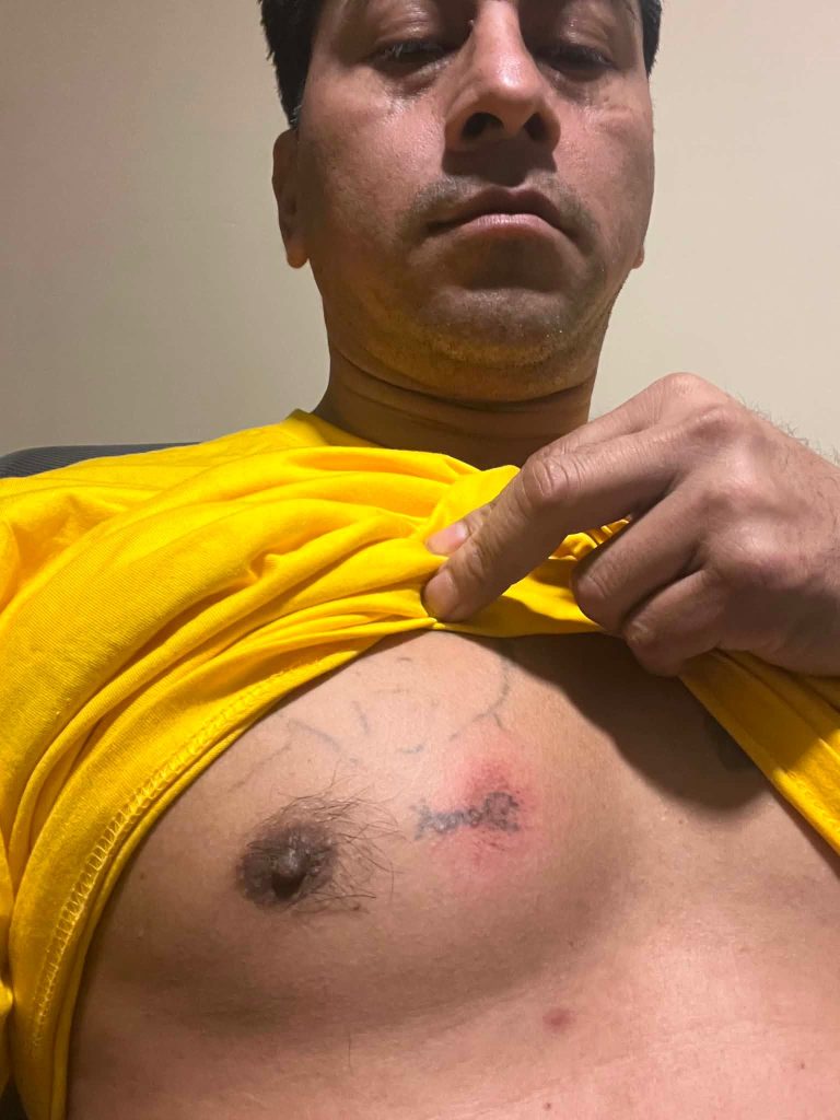 Kenis López denuncia que fue golpeado por agentes del ICE. Cortesía