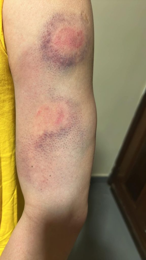 Kenis López denuncia que fue golpeado por agentes del ICE. Cortesía