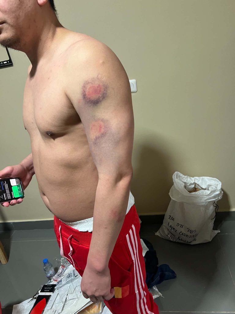 Isaac Cruz denuncia haber sido víctima de maltrato por oficiales de ICE. Cortesía