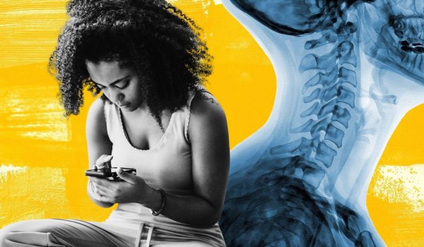 BBC/Getty La vida moderna, incluido el uso frecuente de teléfonos móviles y ordenadores portátiles, es terrible para nuestro cuello.