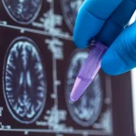 EE.UU. vigila posible brote de peste pulmonar en Rusia