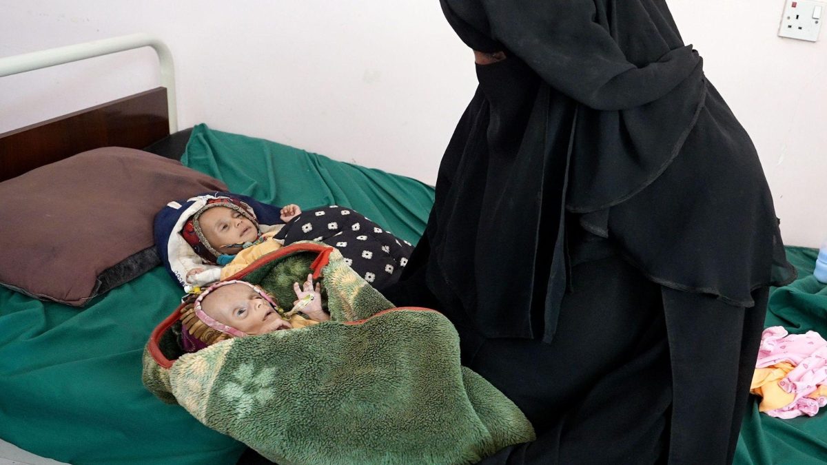 La familia de los gemelos caminó durante tres días antes de llegar al hospital al-Sadaqah en Adén. Foto: BBC Mundo