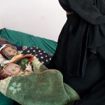 «Solo piel y huesos»: los gemelos recién nacidos que tratan de sobrevivir a la guerra y el hambre en Yemen