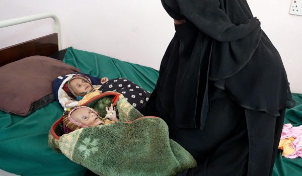 La familia de los gemelos caminó durante tres días antes de llegar al hospital al-Sadaqah en Adén. Foto: BBC Mundo